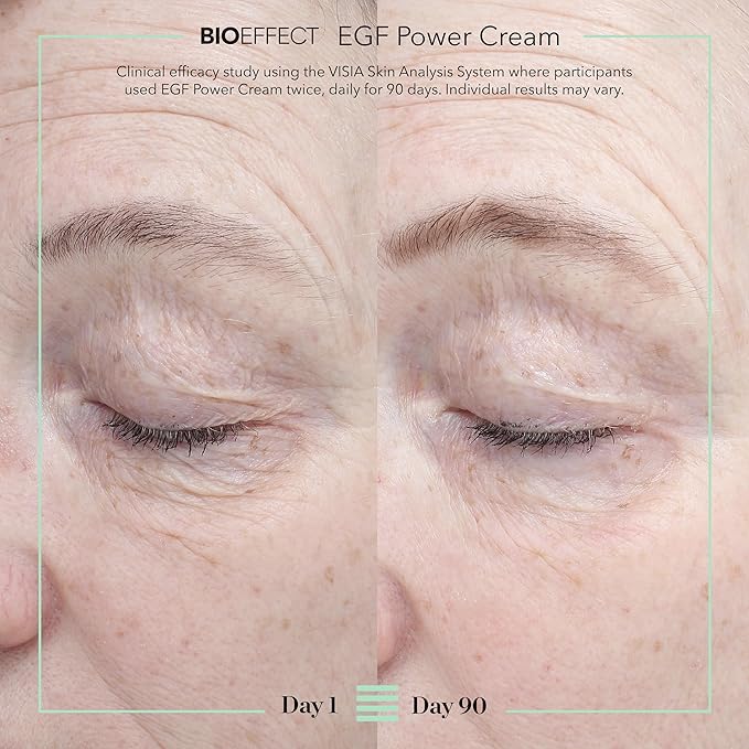 BIOEFFECT EGF Power Cream | Advanced Age-Defying Face & Neck Cream with Epidermal Growth Factor + Hyaluronic Acid + Niacinamide for Wrinkles & Age Spots | 50 mL / 1.69 oz