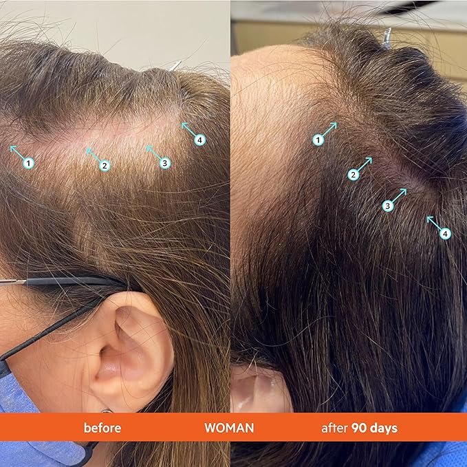 DS Labs For Men & Women Revita Conditioner - Scalp Refreshing Hydration for Fuller Looking, Weightless Hydration, Caffeine, Turmeric, Sulfate & Silicone Free, Color Safe, Refill Pouch 500 mL