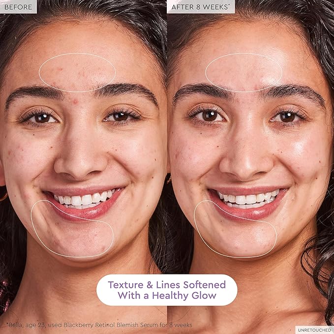 Glow Recipe Gentle Blackberry Retinol Serum, Korean Retinol Night Serum for Sensitive Skin, Triple Retinoids + Glycerin, Clarifying for Blemishes, Smooths Texture and Fine Lines (30ml)